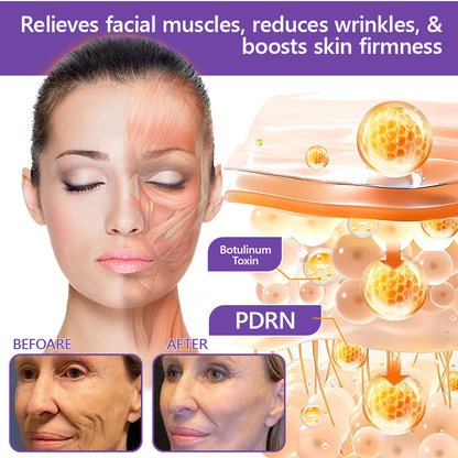 Certified: HISKIN® PDRN Multi-Peptide Massaging Body Roller Cream- Anti-aging, Hydrating, Skin Firming & Lifting, Skin Repair, Even Tone, Acne and Dark Spot Treatment, Wart and Mole Removal, and Psoriasis Relief.