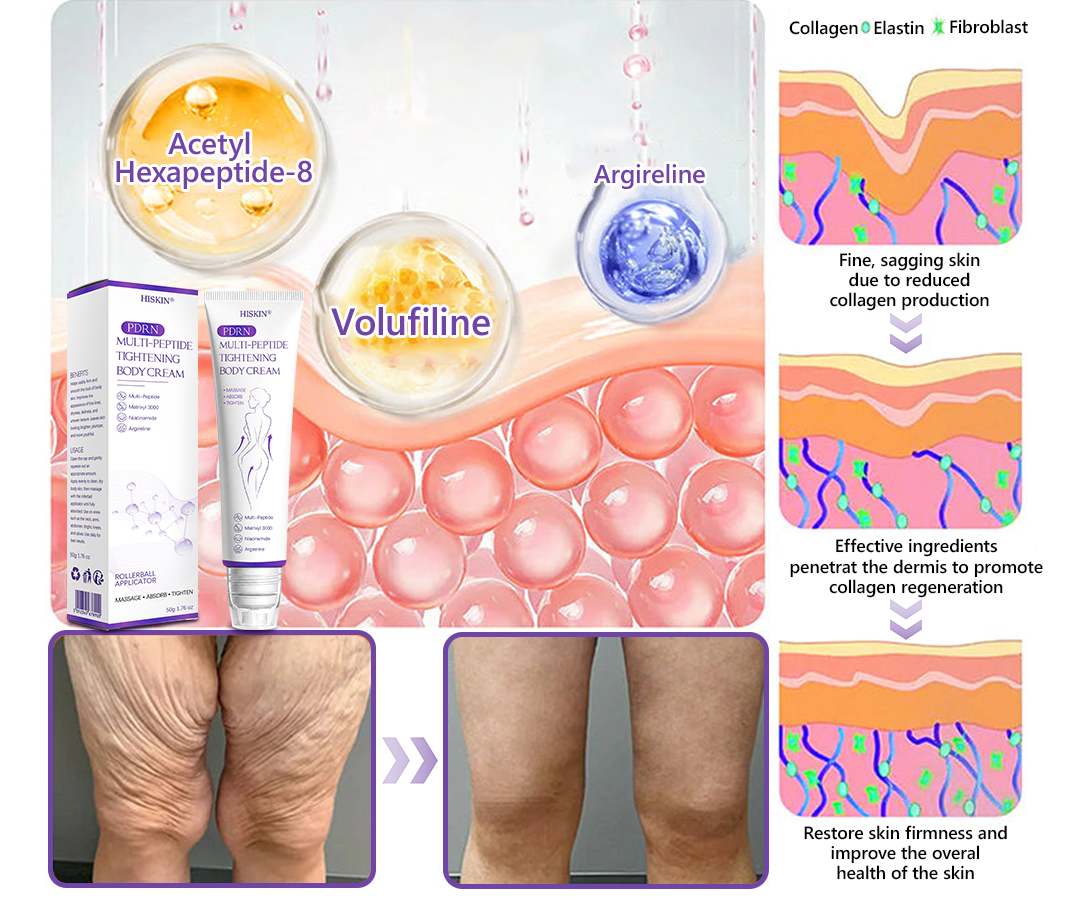 Certified: HISKIN® PDRN Multi-Peptide Massaging Body Roller Cream- Anti-aging, Hydrating, Skin Firming & Lifting, Skin Repair, Even Tone, Acne and Dark Spot Treatment, Wart and Mole Removal, and Psoriasis Relief.