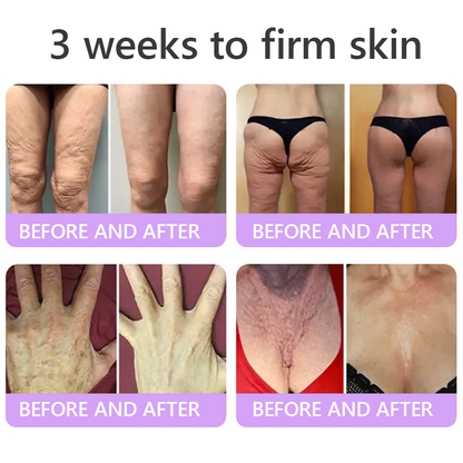 Certified: HISKIN® PDRN Multi-Peptide Massaging Body Roller Cream- Anti-aging, Hydrating, Skin Firming & Lifting, Skin Repair, Even Tone, Acne and Dark Spot Treatment, Wart and Mole Removal, and Psoriasis Relief.