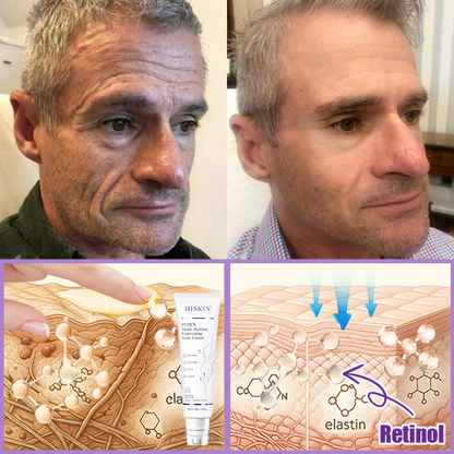 Certified: HISKIN® PDRN Multi-Peptide Massaging Body Roller Cream- Anti-aging, Hydrating, Skin Firming & Lifting, Skin Repair, Even Tone, Acne and Dark Spot Treatment, Wart and Mole Removal, and Psoriasis Relief.